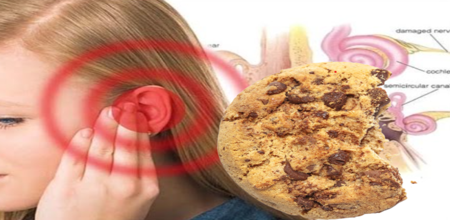 What is Cookie Bite Hearing Loss? Causes, Symptoms & Treatment